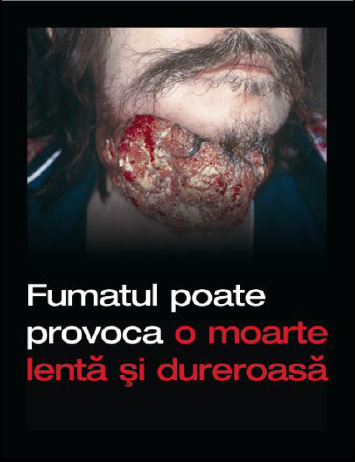 Romania 2008 Health Effects death - diseased organ, gross, Romania